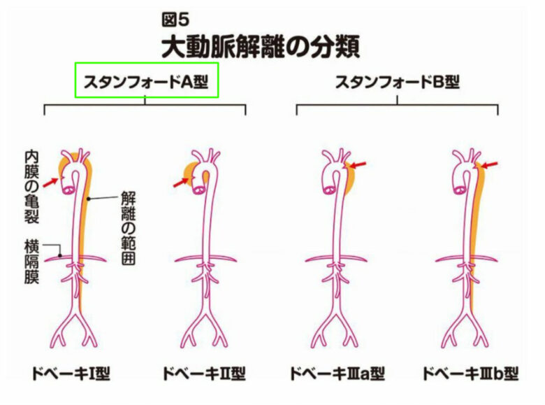 もんたよしのりはワクチン推奨派